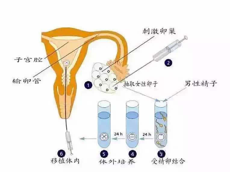 2024重庆试管婴儿成功率排行，附供卵试管费用一览!